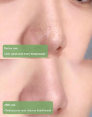 🍵Buy 1 Get 1 Free🍵 Deep Cleanse Green Tea Mask